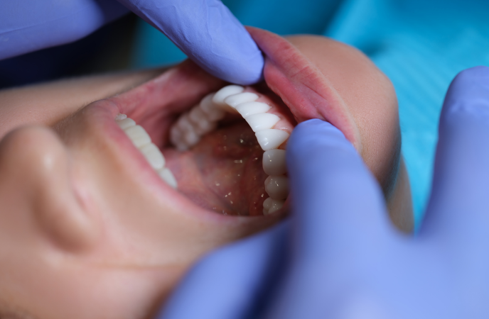 Understanding the Risks: What Everyone Should Know About Oral Cancer